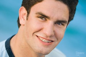 Young man smiling at camera with blue sky background for orthodontics practice portrait.
