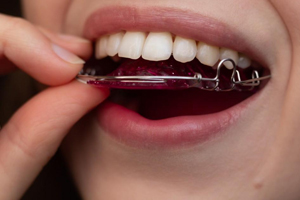 Person applying dark red lip gloss with applicator wand, showcasing healthy white teeth.
