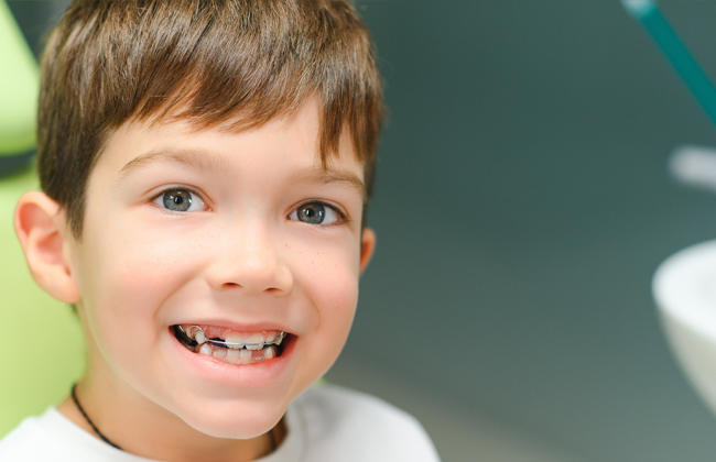 Young boy smiling at camera displaying teeth in bright, cheerful setting for orthodontics clinic.