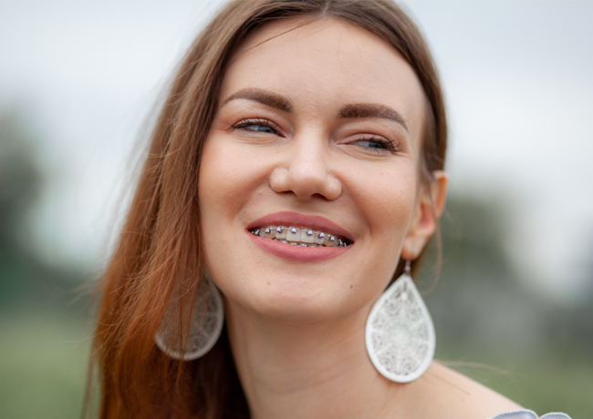 Woman with braces smiling outdoors, wearing teardrop earrings in natural setting.