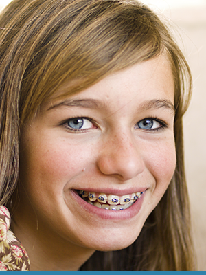 Blue Wave Orthodontics Featured Image Blue Wave Darien CT RYE NY 20